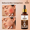 Newish Pure & Natural Clove Oil For Teeth Pain Skin & Hair 30Ml