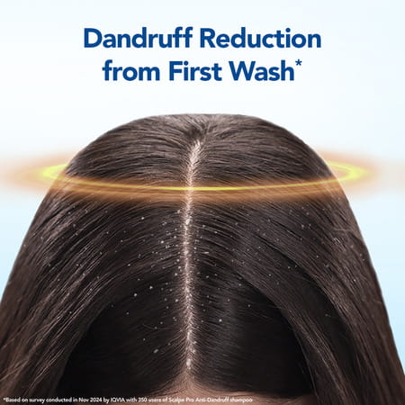 Scalpe Pro Anti-Dandruff Shampoo Bottle Of 200 Ml