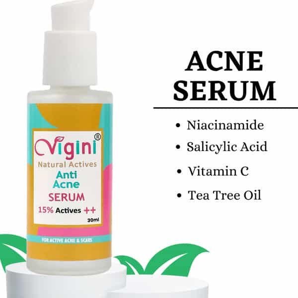 Vigini Anti-Acne Oil Control Foaming Face Wash 150Ml, Serum 30Ml, Mattifying Moisturizer Cream 50Ml