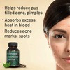 Gynoveda Anti Acne Ayurvedic Medicine Clears Pimples Mark Scars Pigmentation 3 Bottle 720 Tablets