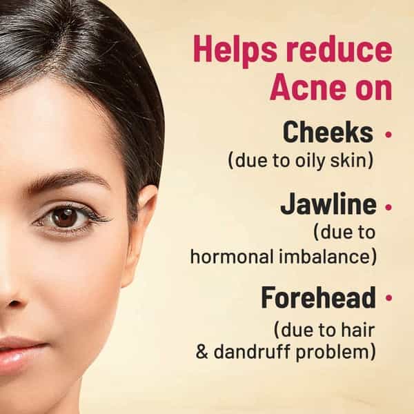 Gynoveda Anti Acne Ayurvedic Medicine Clears Pimples Mark Scars Pigmentation 3 Bottle 720 Tablets