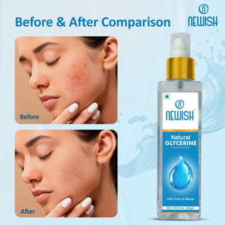 Newish Glycerine For Face And Skin Care 250Ml