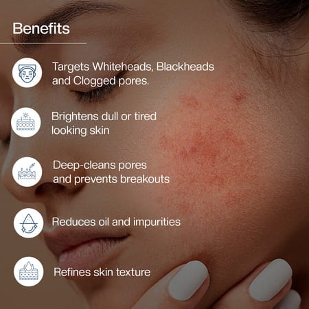 Maxisoft Advance Cleansing | 3 Way Antibacterial Action | Face Wash | Tube | 100 Ml | Pack Of 3