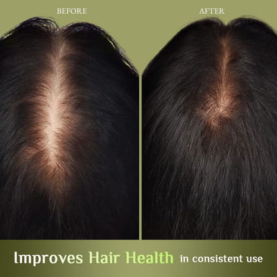 View product image 4
