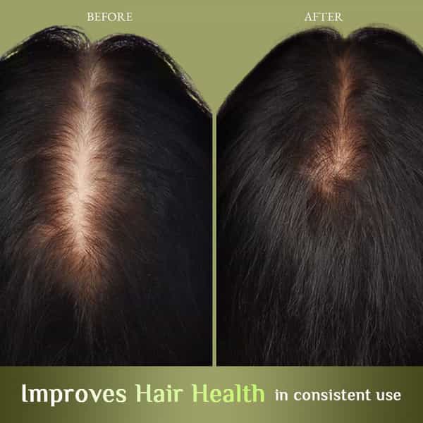 Richfeel Brahmi Jaborandi Nourishing Hair Oil 80 Ml