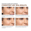 Yuderma Skindose Time Filler | 50 Ml