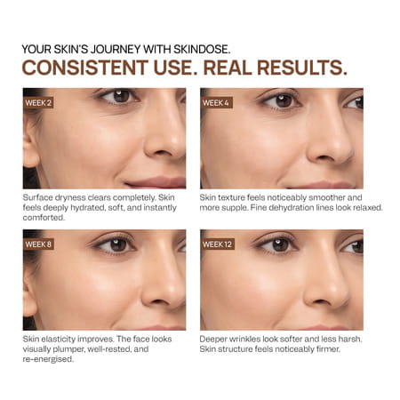 Yuderma Skindose Time Filler | 50 Ml