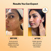 Setu Skin Radiance Combo For Brightening & Glow | 210G Marine Collagen Powder With 30 Fizz Tabs