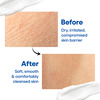Epiclin Gentle Cleansing Lotion For Face & Body 150 Ml