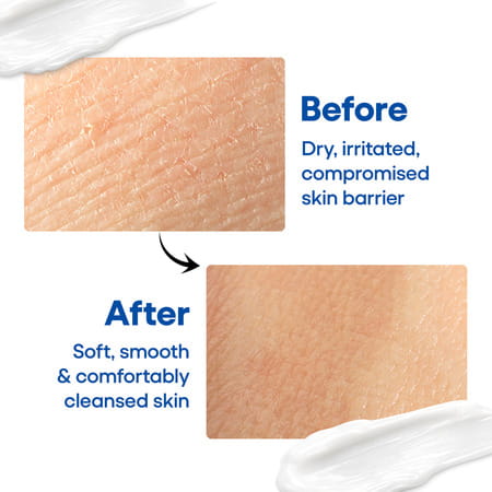 Epiclin Gentle Cleansing Lotion For Face & Body 150 Ml