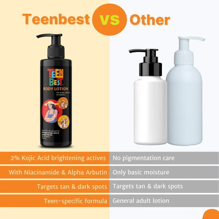 Healthbest Teens Body Lotion With Kojic Acid & Vitamin E - 200ml For Boys & Girls Ages 13-19