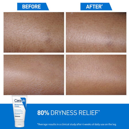 Cerave Moisturizing Cream For Dry To Very Dry Skin - 177Ml
