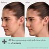 Lotus Dermabotanics Kojic Acid + Multi Berry Ampoule Cream | Reduces Blemishes Enhances Radiance 50g