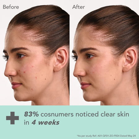 Lotus Dermabotanics Kojic Acid + Multi Berry Ampoule Cream | Reduces Blemishes Enhances Radiance 50g