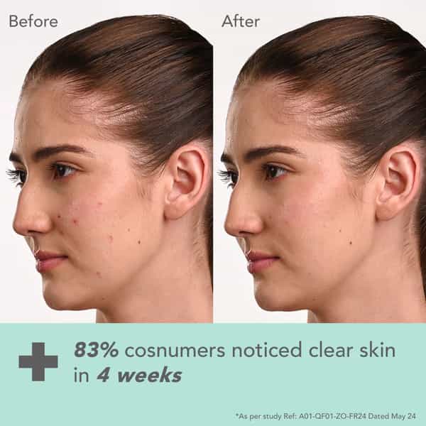 Lotus Dermabotanics Kojic Acid + Multi Berry Ampoule Cream | Reduces Blemishes Enhances Radiance 50G
