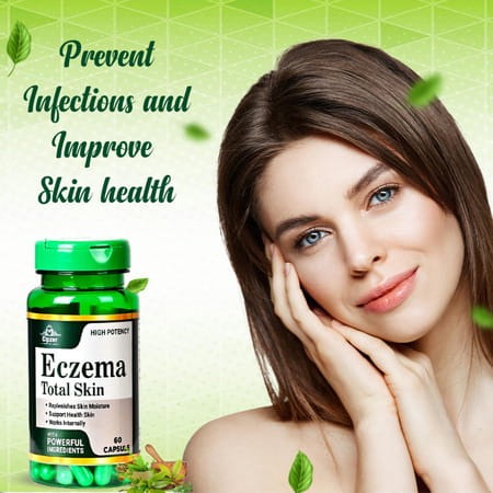 Cipzer Eczema Total Skin Capsule-Reduce Eczema Symptom,Hydrate Skin & Reduce Inflammation-60 Capsule