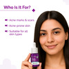 10% Niacinamide Face Serum For Acne Marks & Acne Prone Skin - 10 Ml