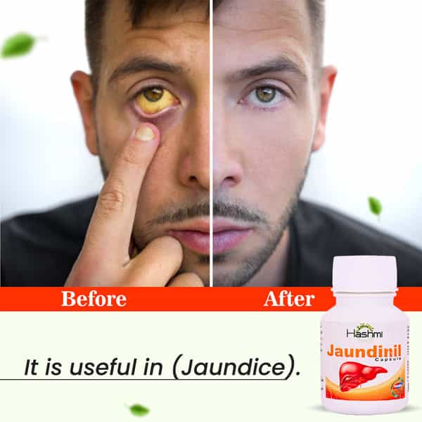 Hashmi Jaundinil Jaundice Care Capsule 20 Capsules