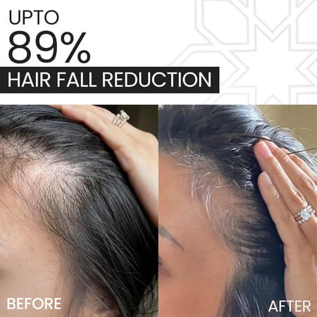 Novegrow Stem Intensive Hair Growth Serum 60 Ml