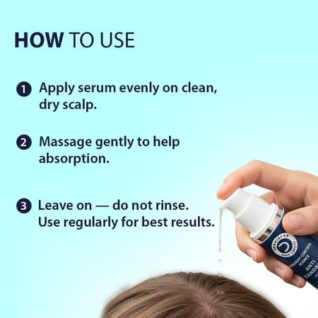 Dermistry Anti Dandruff Piroctone Climbazole Salicylic Acid Hair Serum Flakes Dry Itchy Scalp 50ml