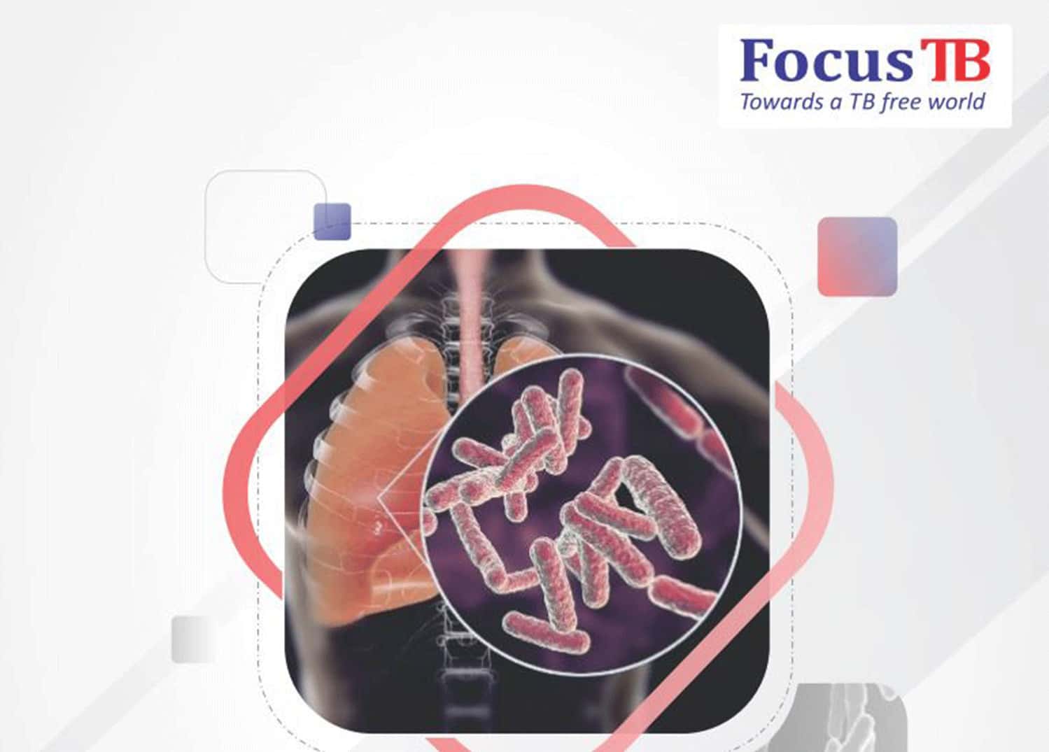 Booklet - Focus Tb 1 Pc.