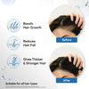 Scalpe Pro Bottle Of 30Ml Hair Serum