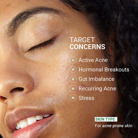 Sereko Skin Clearing Syrup Mixed Berry Flavour Blood Purifier For Acne & Pimple Control 200 Ml