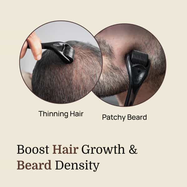 Formen Derma Roller For Hair Growth | 540 (0.5 Mm) Titanium Micro-Needles | Growth Activator (1 Pc)