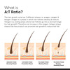 Minimalist Hair Growth Actives 18% Hair Serum (30ml)