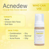 Acnedew Antiacne & Antipimple Foaming Face Wash 100 Ml | Salicylic Acid (Pack Of 2)