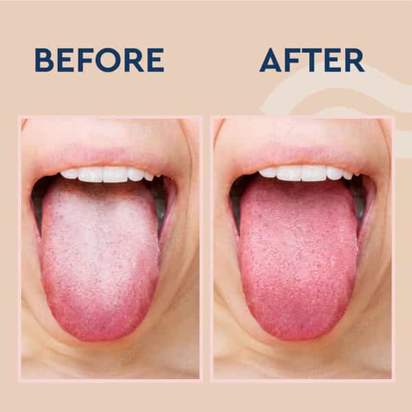 Gubb Copper Tongue Cleaner