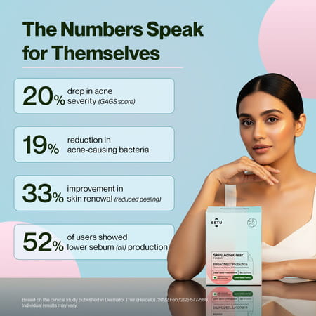 Setu Skin Acneclear+ | Bifiacnel Probiotics | Chasteberry & Chamomile | Green Apple - 30 Sachets