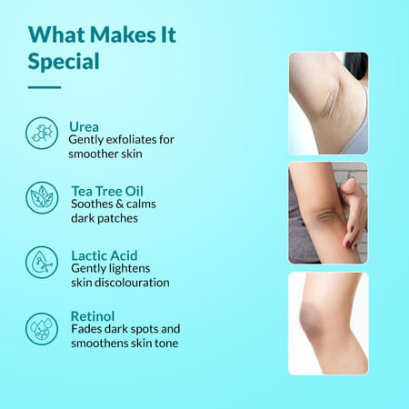 Fixderma Nigrifix Cream For Acanthosis Nigricans For Dark Neck Ankles - 100g