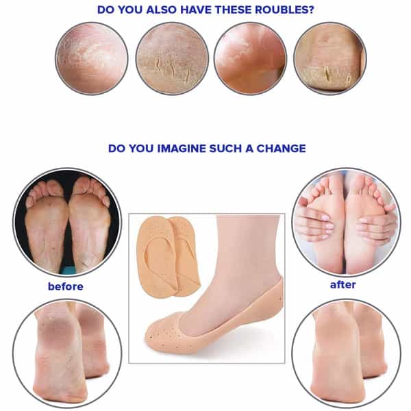 Dr Foot Silicone Moisturizing Heel Socks|Dry, Cracked Heels, Rough Skin, Dead Skin | Size S - 1 Pair