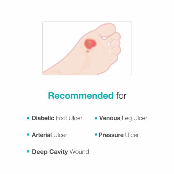 Maxiocel Wound Care Dressing For Diabetic Foot Ulcers (5Cm X 10Cm) - Box Of 5 Units
