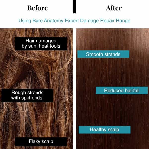 Bare Anatomy Expert Damage Repair Shampoo To Repair And Strengthen Brittle & Weak Hair 250 Ml