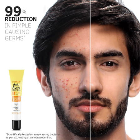 Ustraa Anti-Acne Spot Gel With Neem & Vitamin B3 - 15ml