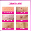 Cos-Iq Abp 22% Regular Use Exfoliating Peel Aha 15% + Ph 5% + Bha 2% Peeling Solution 30Ml