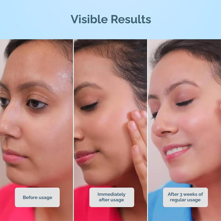 Cos-Iq Airgel Nmf 15% For Oily Skin Moisturizer For Men & Women - 100 Ml