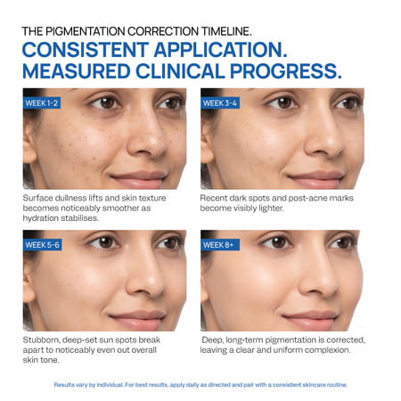 Yuderma Melarid 5X Correction De-Pigmentation Serum | 40 Ml