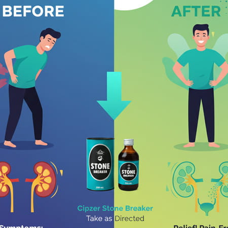 Cipzer Stone Breaker Syrup 200ml | Supports Kidney Health & Urinary Wellness