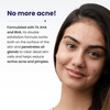 Re'equil Acne Clarifying Gel