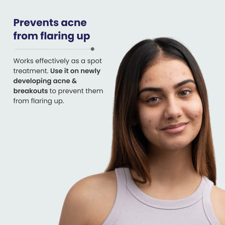 Re'Equil Acne Clarifying Gel