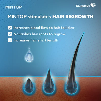 Mintop Forte 5% Minoxidil Bottle Of 60ml Solution