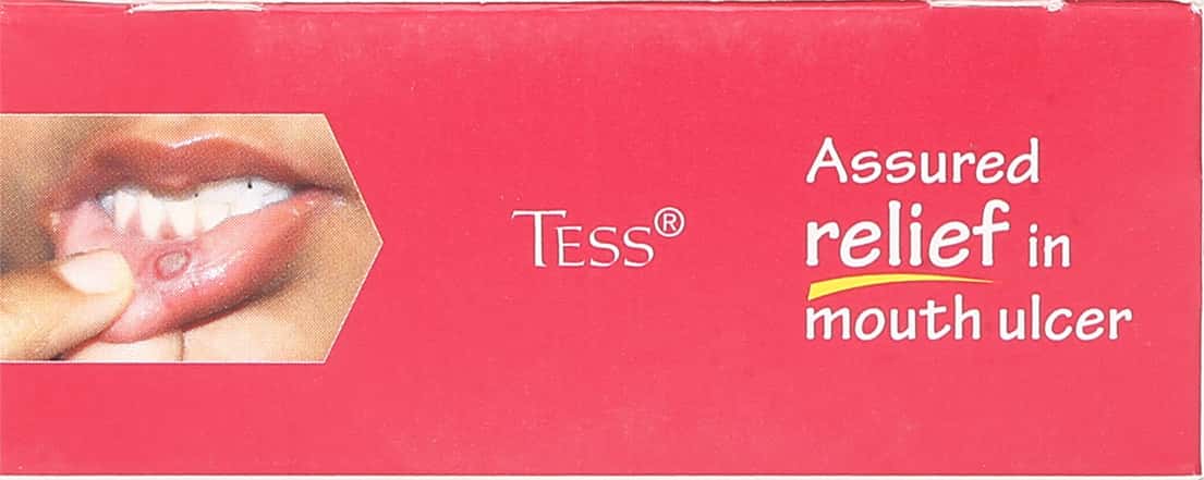 tess tube of 7.5gm buccal paste