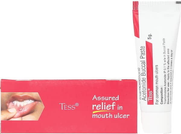 Tess Tube Of 5gm Buccal Paste