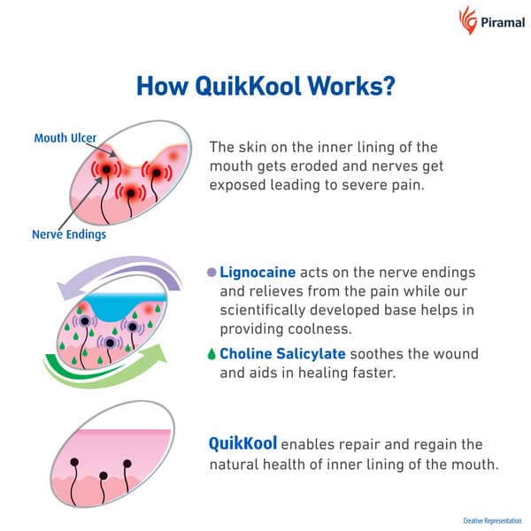 Quik Kool Mouth Ulcer Gel 10gm