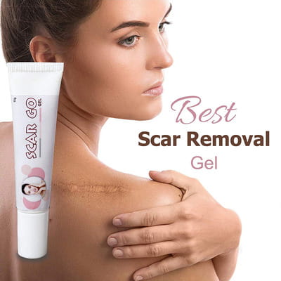 Scar Go Tube Of 15gm Cream