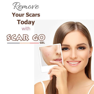 Scar Go Tube Of 15gm Cream