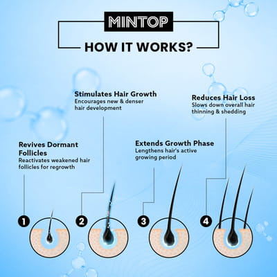 Mintop Forte 5% Minoxidil Bottle Of 120ml Solution